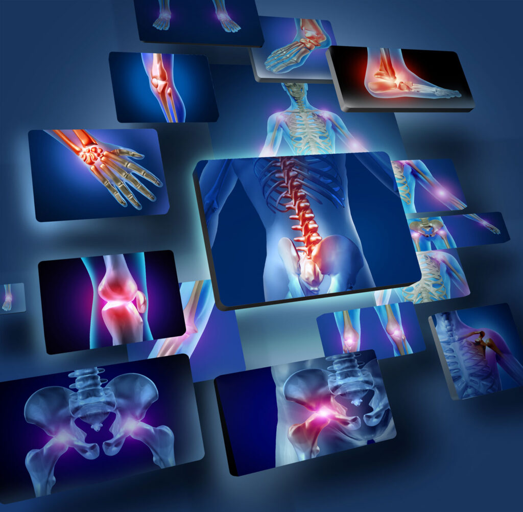 Fibromyalgie Symptome Praxis am Fürstenhof in Werne Dr. Couckyut